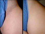 Шалашовка отрастила светлые волосики на киске Шалашовка отрастила светлые волосики на киске